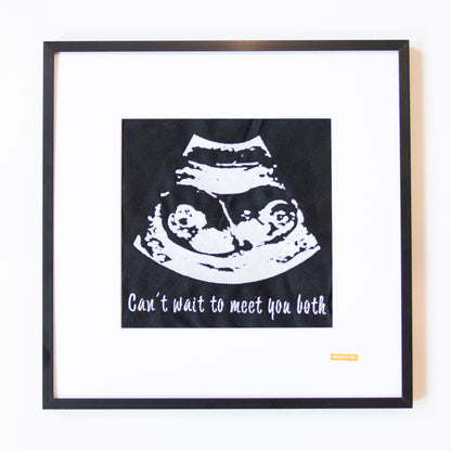 Custom Baby Ultrasound Embroidery Art | Back&White