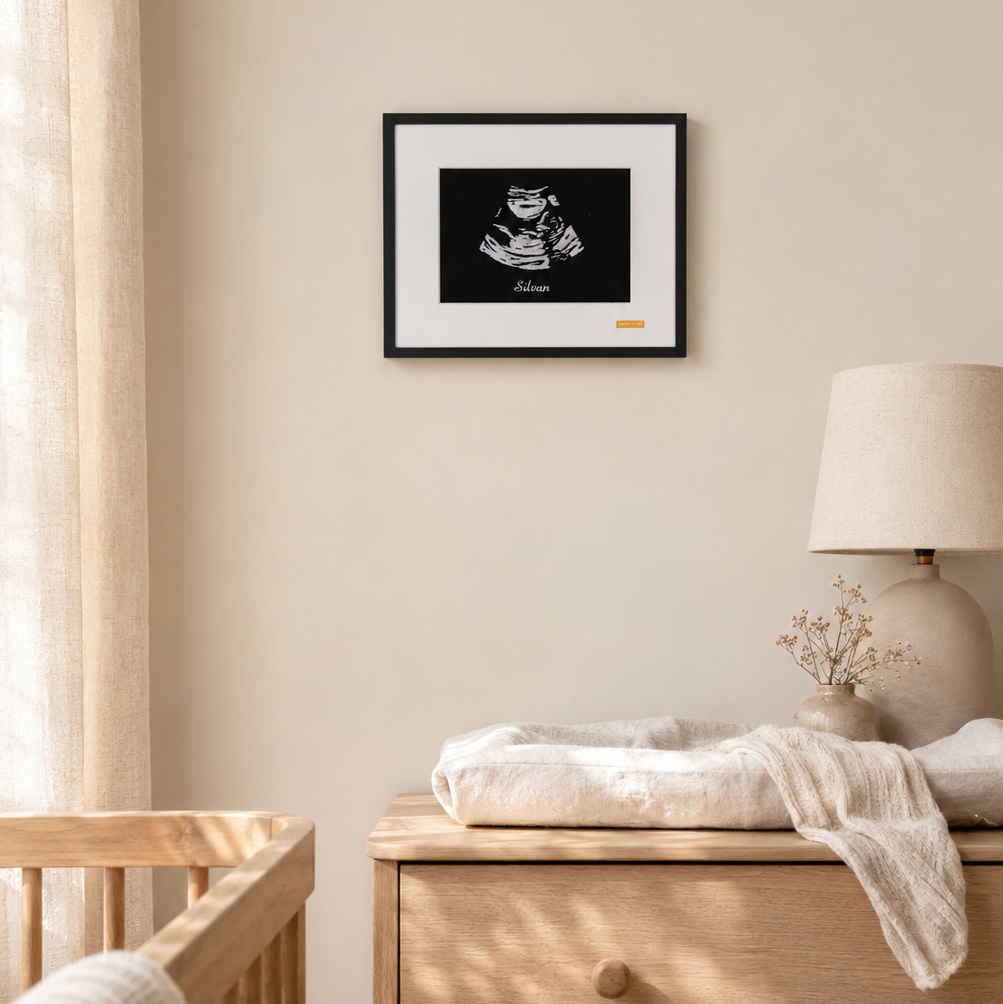 Custom Baby Ultrasound Embroidery Art | Back&White