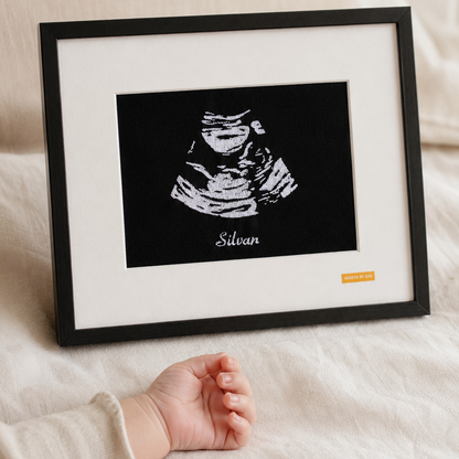 Custom Baby Ultrasound Embroidery Art | Back&White